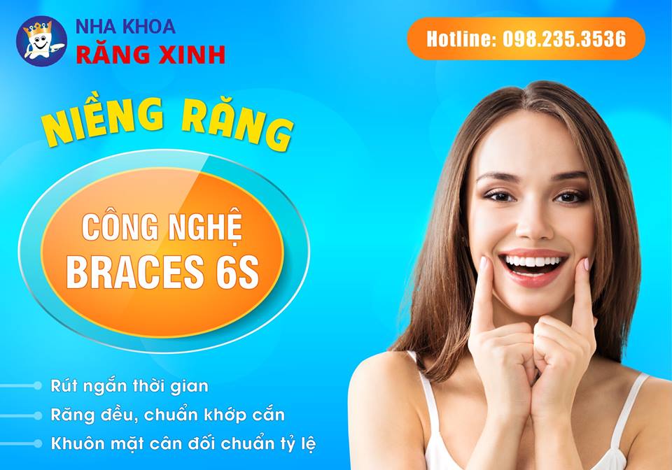 niềng răng pha lê