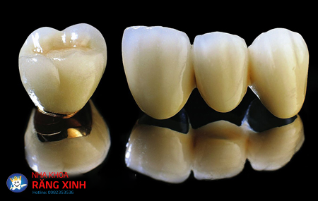 bọc răng sứ có mấy loại