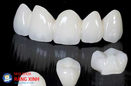 bọc răng sứ có mấy loại