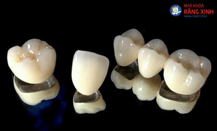 rang-su-titan-2-1 Mão răng