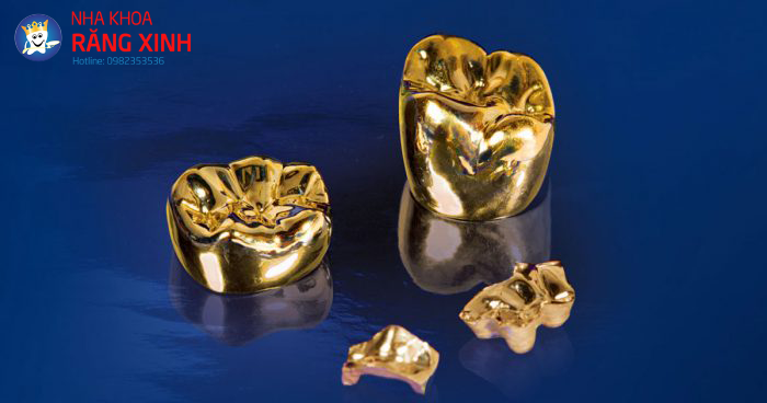 rang-vang-e1514271597655-1 Mão răng