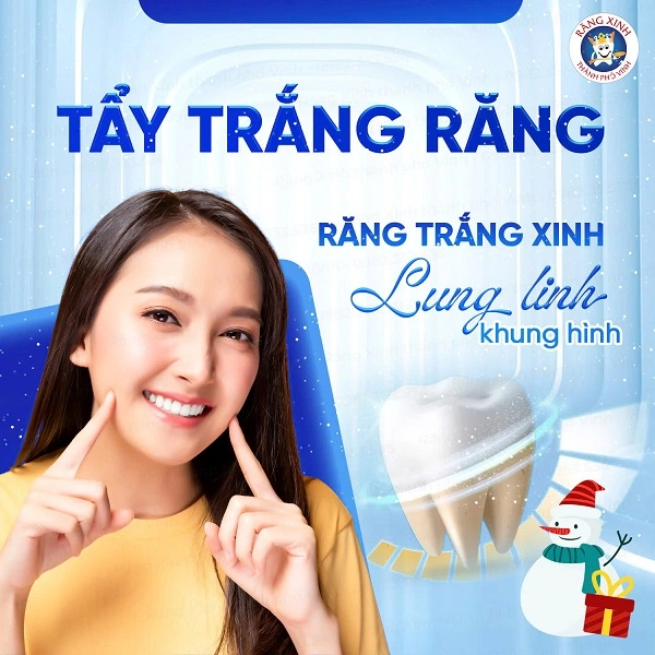 Nếu bạn duy trì tốt thói quen vệ sinh răng miệng và hạn chế thực phẩm đậm màu, hiệu quả trắng sáng có thể duy trì từ 1 – 2 năm