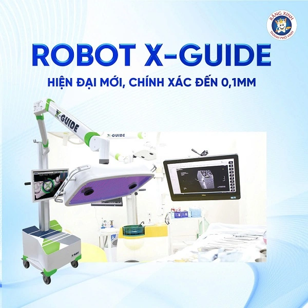 Trong những ca phẫu thuật phức tạp như cấy ghép implant, công nghệ Robot X - Guide đóng vai trò như một “bản đồ giải phẫu số” hỗ trợ bác sĩ