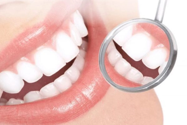 Bọc răng sứ được xem là lựa chọn hiệu quả giúp cải thiện hình dáng, màu sắc răng và mang lại nụ cười tự tin cho nhiều người