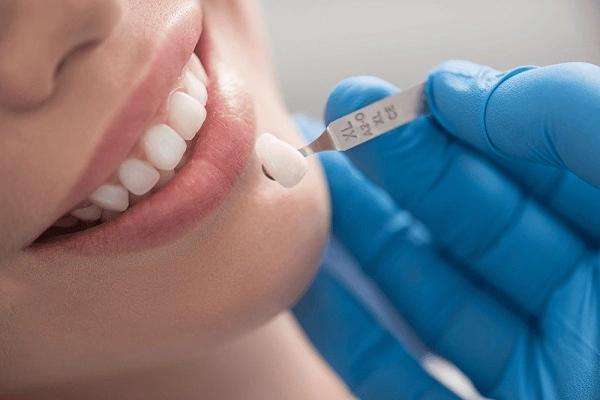 Một quy trình bọc răng sứ đạt chuẩn không chỉ mang lại vẻ đẹp tự nhiên mà còn đảm bảo an toàn tuyệt đối cho răng thật