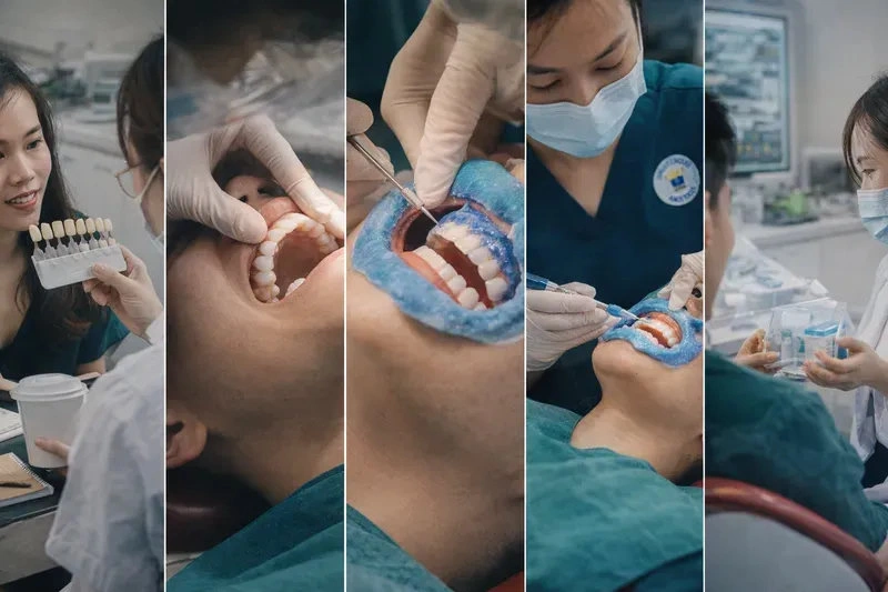 Quy trình tẩy trắng răng tại nha khoa theo chuẩn an toàn (từng bước)