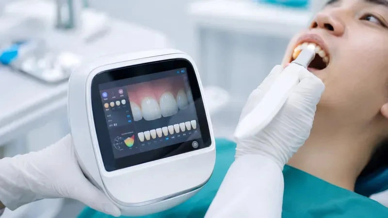 Thiết bị đo màu răng hoạt động như thế nào?